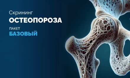 -15% на Базовый Скрининг Остеопороза