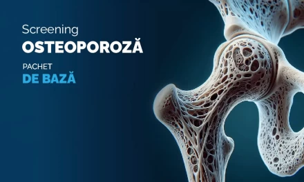 -15% la Screeningul Osteoporoză (De Bază)