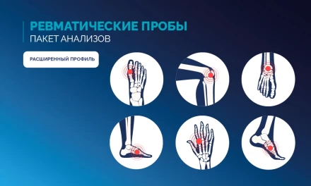 Ревматические пробы, расширенный профиль