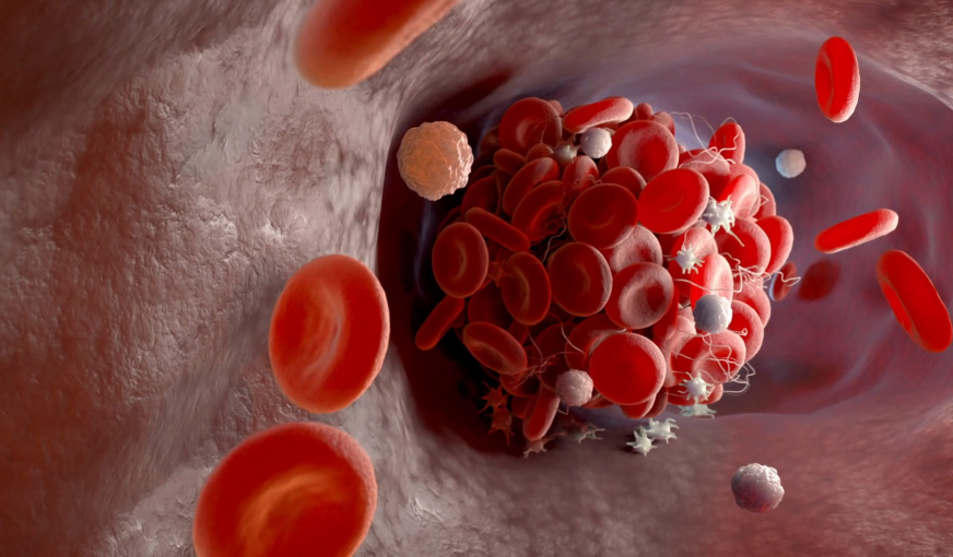 Profil antifosfolipidic (APS-complet) 